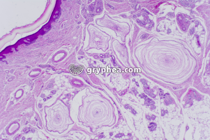 Peau du doigt avec corpuscules de Pacini x10 - gryphea.org